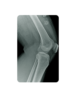 X-ray film